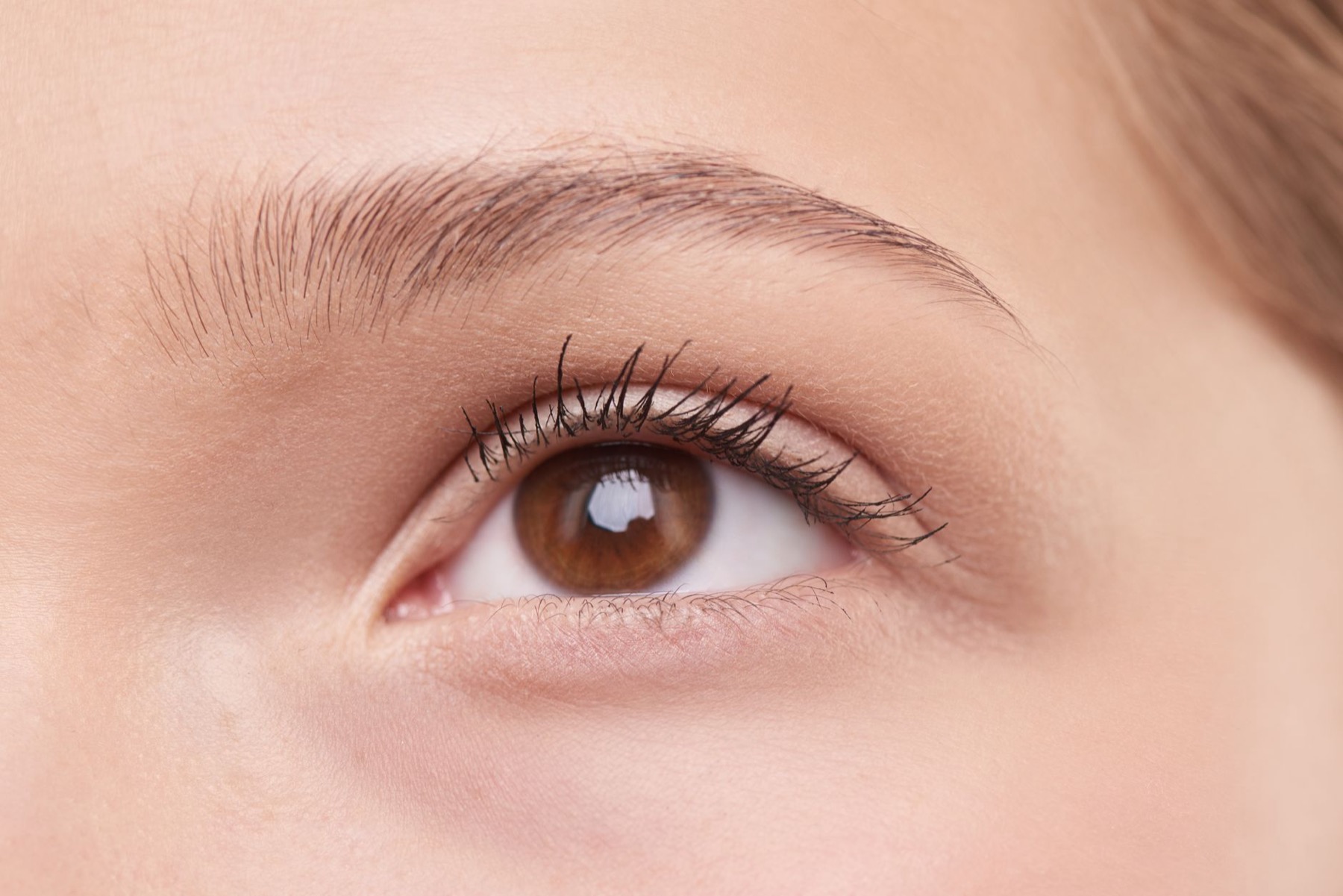 Brow-Lift